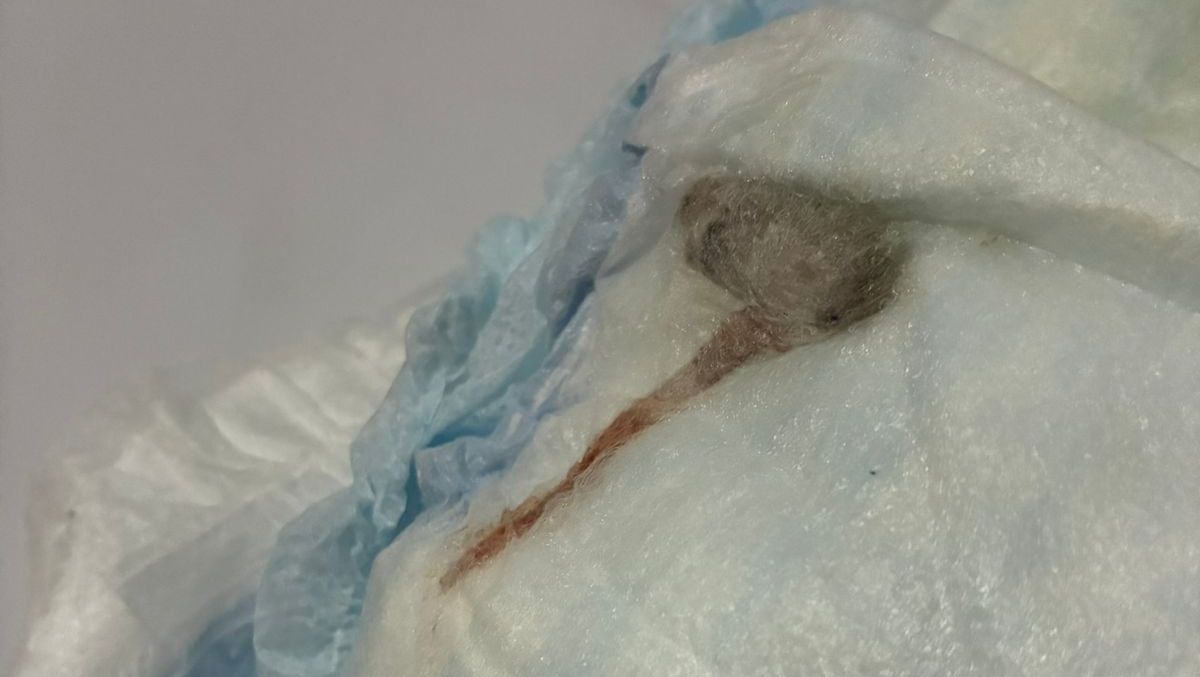 Mancha em fralda, denunciada como rato, era material plástico, diz laudo Mancha em fralda, denunciada como rato, era material plástico, diz laudo