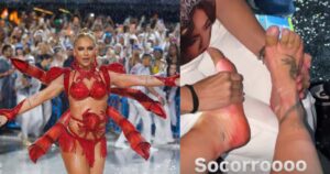 Virginia mostra os pés machucados após último ensaio na Marquês de Sapucaí