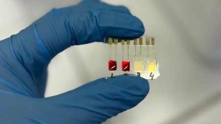 USP cria biossensor barato que identifica câncer de pâncreas em 10 minutos